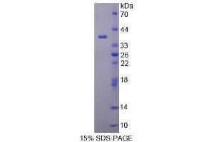 SDS-PAGE analysis of Human MYB Protein. (MYB Protein)