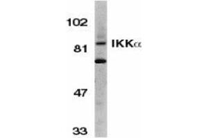 Western blot analysis of IKK alpha in Jurkat whole cell lysate with AP30405PU-N IKK alpha antibody (C3) at 1/500 dilution.