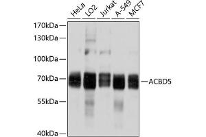 Western blot analysis of extracts of various cell lines, using  antibody (ABIN6131213, ABIN6136419, ABIN6136420 and ABIN6214901) at 1:1000 dilution. (ACBD5 antibody  (AA 170-440))