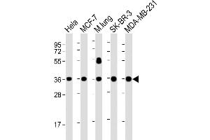 Lane 1: HeLa, Lane 2: MCF-7, Lane 3: mouse lung, Lane 4: SK-BR-3, Lane 5: MDA-MB-231 cell lysate at 20 µg per lane, probed with bsm-51380M WNT4 (1698CT540. (WNT4 antibody)