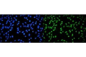 IF analysis of RPA32/RPA2 using anti-RPA32/RPA2 antibody (ABIN7601380). (RPA2 antibody  (AA 34-254))