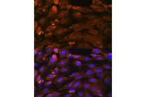 Immunofluorescence analysis of C6 cells using PTCH1 antibody (ABIN1682368, ABIN1682367, ABIN3015342, ABIN3015343 and ABIN6213997) at dilution of 1:100. (Patched 1 antibody  (AA 1214-1312))