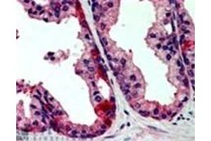 Image no. 1 for anti-TAO Kinase 3 (TAOK3) (Internal Region) antibody (ABIN374459) (TAO Kinase 3 antibody  (Internal Region))