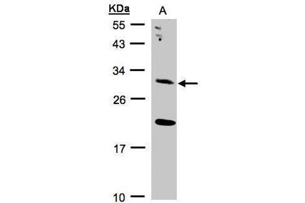 UROS antibody