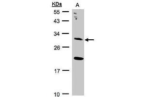 WB Image Sample(30 ug whole cell lysate) A:293T 12% SDS PAGE antibody diluted at 1:2000 (UROS antibody)