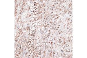 Immunohistochemistry (IHC) image for anti-Laminin, gamma 1 (LAMC1) (AA 1300-1609) antibody (ABIN7268186)
