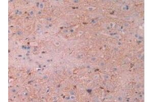 Detection of CAPN1 in Rat Spinal Cord Tissue using Polyclonal Antibody to Calpain 1 (CAPN1) (CAPN1 antibody)