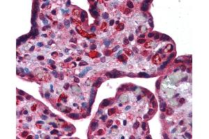 Anti-DLX6 antibody IHC of human placenta. (DLX6 antibody  (AA 36-85))