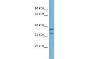Image no. 1 for anti-Ral GEF with PH Domain and SH3 Binding Motif 2 (RALGPS2) (AA 201-250) antibody (ABIN6742101) (RALGPS2 antibody  (AA 201-250))