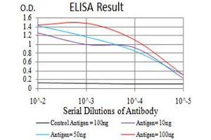 Black line: Control Antigen (100 ng),Purple line: Antigen (10 ng), Blue line: Antigen (50 ng), Red line:Antigen (100 ng) (FOXP2 antibody  (AA 641-740))