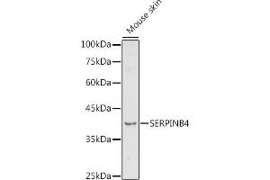 Western blot analysis of extracts of Mouse skin, using SERPINB4 antibody (ABIN7270243) at 1:1000 dilution. (SERPINB4 antibody  (C-Term))