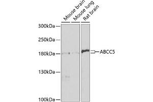 Western blot analysis of extracts of various cell lines, using  antibody (ABIN3017213, ABIN3017214, ABIN3017215 and ABIN6219998) at 1:1000 dilution. (ABCC5 antibody  (AA 1-179))