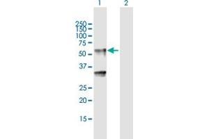 Western Blot analysis of LIPH expression in transfected 293T cell line by LIPH MaxPab polyclonal antibody. (LIPH antibody  (AA 1-451))
