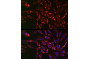 Immunofluorescence analysis of NIH/3T3 cells using TRIP2 Rabbit pAb (ABIN6129947, ABIN6149464, ABIN6149465 and ABIN6222516) at dilution of 1:50 (40x lens). (TRAF3IP2 antibody  (AA 1-300))