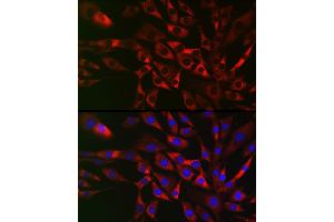 Immunofluorescence analysis of NIH/3T3 cells using TRIP2 Rabbit pAb (ABIN6129947, ABIN6149464, ABIN6149465 and ABIN6222516) at dilution of 1:50 (40x lens). (TRAF3IP2 antibody  (AA 1-300))