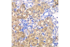 Immunohistochemistry of paraffin-embedded rat kidney using HPD antibody. (HPD antibody)