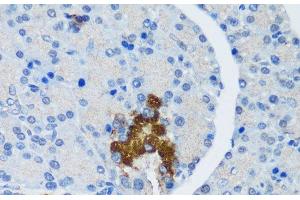 Immunohistochemistry of paraffin-embedded Rat pancreatic islet using TSC1 Polyclonal Antibody at dilution of 1:200 (40x lens). (TSC1 antibody)