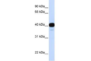WB Suggested Anti-FOXL1 Antibody Titration: 0. (FOXL1 antibody  (Middle Region))
