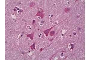 Anti-EPHX2 antibody IHC of human brain, cortex neurons. (EPHX2 antibody)