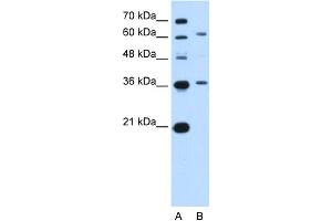 WB Suggested Anti-ZSCAN12 Antibody Titration:  5. (ZSCAN12 antibody  (N-Term))