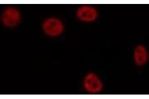 ABIN6275887 staining HepG2 by IF/ICC. (LHX1 antibody  (Internal Region))