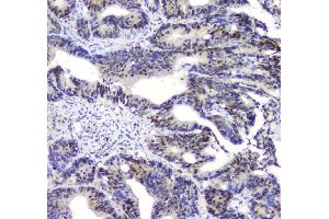IHC analysis of SQSTM1 using anti-SQSTM1 antibody (ABIN3043937). (SQSTM1 antibody  (N-Term))