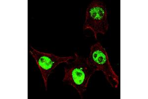 Fluorescent confocal ige of HeLa cells stained with phospho-SD3- antibody.
