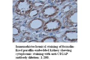 Image no. 1 for anti-CD2-Associated Protein (Cd2ap) (C-Term) antibody (ABIN791046) (CD2AP antibody  (C-Term))