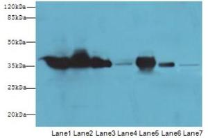 Western Blotting (WB) image for anti-Glyceraldehyde-3-Phosphate Dehydrogenase (GAPDH) (AA 3-105) antibody (ABIN2931072) (GAPDH antibody  (AA 3-105))