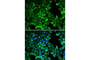 Immunofluorescence analysis of U2OS cell using PDLIM5 antibody. (PDLIM5 antibody)