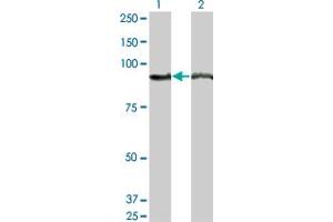 Western Blot analysis of AMPD2 expression in transfected 293T cell line by AMPD2 monoclonal antibody (M04), clone 2G8. (AMPD2 antibody  (AA 86-185))