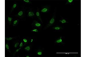 Immunofluorescence of purified MaxPab antibody to HMGA1 on HeLa cell. (HMGA1 antibody  (AA 1-107))