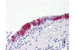 Anti-ARVCF antibody IHC of human lung, respiratory epithelium. (ARVCF antibody  (AA 863-963))