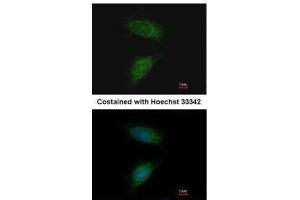 Immunofluorescence (IF) image for anti-Matrix Metalloproteinase 2 (MMP2) antibody (ABIN2855854)