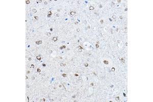 Immunohistochemistry (IHC) image for anti-Microtubule-Associated Protein tau (MAPT) (pSer396) antibody (ABIN7268523)