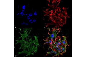 Immunocytochemistry/Immunofluorescence analysis using Mouse Anti-GABA-B Receptor 1 Monoclonal Antibody, Clone S93A-49 (ABIN1027717). (GABBR1 antibody  (AA 873-977))