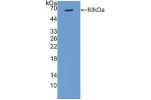 Detection of Recombinant CCND1, Human using Polyclonal Antibody to Cyclin D1 (CCND1) (Cyclin D1 antibody  (AA 1-295))
