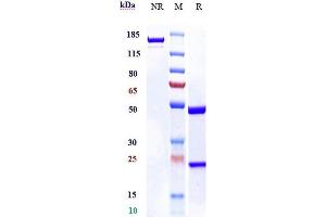 Anti-S100A4 Reference Antibody (LK-1) on SDS-PAGE under reducing (R) condition.