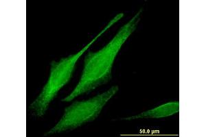 Immunofluorescence of monoclonal antibody to MORG1 on HeLa cell. (MORG1 antibody  (AA 171-262))