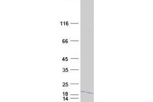 Chromosome 14 Open Reading Frame 119 (C14ORF119) protein (Myc-DYKDDDDK Tag)