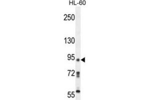 Western Blotting (WB) image for anti-KRI1 Homolog (KRI1) antibody (ABIN5015220) (KRI1 antibody)