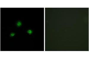 Immunofluorescence analysis of A549 cells, using Ubinuclein Antibody. (Ubinuclein 1 antibody  (AA 161-210))