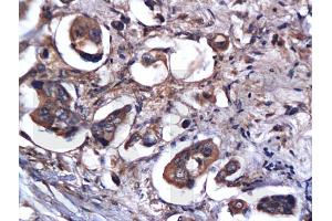 Formalin-fixed and paraffin embedded rat brain labeled with Anti-Caspase-9 Polyclonal Antibody, Unconjugated (ABIN724160) 1:200 followed by conjugation to the secondary antibody and DAB staining (Caspase 9 antibody  (AA 11-120))