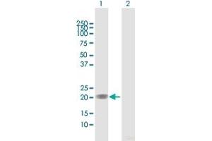 Western Blot analysis of MGMT expression in transfected 293T cell line by MGMT MaxPab polyclonal antibody. (MGMT antibody  (AA 1-207))