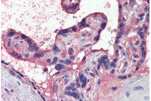 Placenta, Human: Formalin-Fixed, Paraffin-Embedded (FFPE) (Nodal antibody  (AA 242-253))