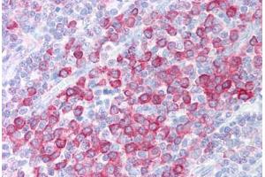 Human Tonsil (formalin-fixed, paraffin-embedded) stained with C1QTNF4 antibody ABIN213915 at 5 ug/ml followed by biotinylated goat anti-rabbit IgG secondary antibody ABIN481713, alkaline phosphatase-streptavidin and chromogen. (C1QTNF4 antibody  (C-Term))