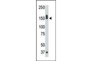 The DAPK1 polyclonal antibody is used in Western blot to detect DAPK1 in mouse liver tissue lysate. (DAP Kinase 1 antibody  (C-Term))