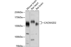Western blot analysis of extracts of various cell lines, using CD2 antibody (ABIN6130178, ABIN6137811, ABIN6137812 and ABIN6214454) at 1:1000 dilution. (CACNA2D2 antibody  (AA 20-200))
