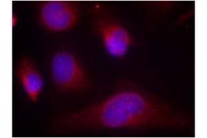 Image no. 3 for anti-Eukaryotic Translation Initiation Factor 2-alpha Kinase 2 (EIF2AK2) (Thr446) antibody (ABIN197544)