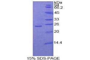 SDS-PAGE analysis of Human Protein Kinase C zeta Protein.